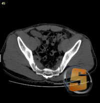 3D-Doctor